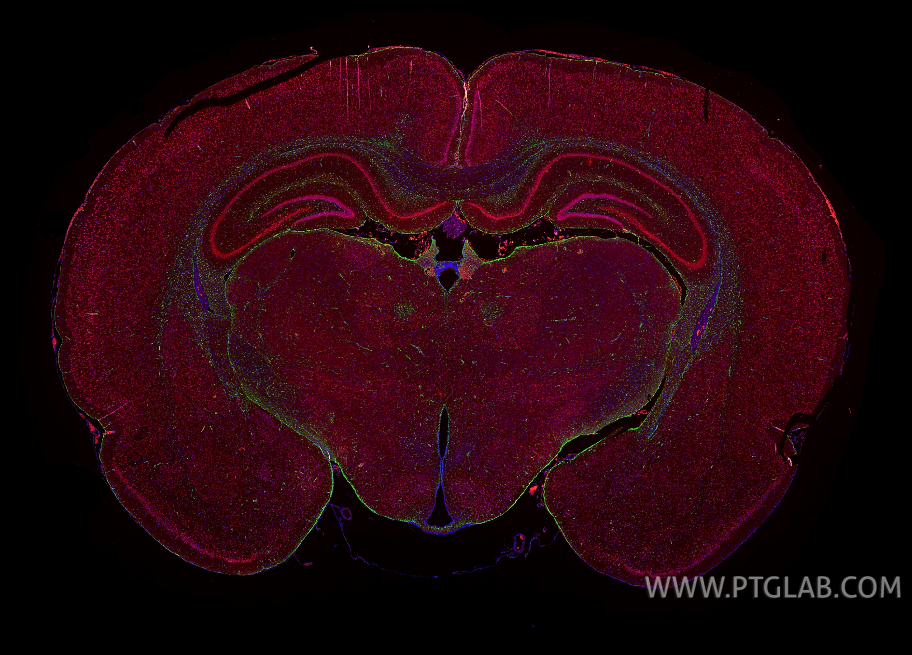 Immunofluorescence (IF) / fluorescent staining of rat brain tissue using NeuN Polyclonal antibody (26975-1-AP)