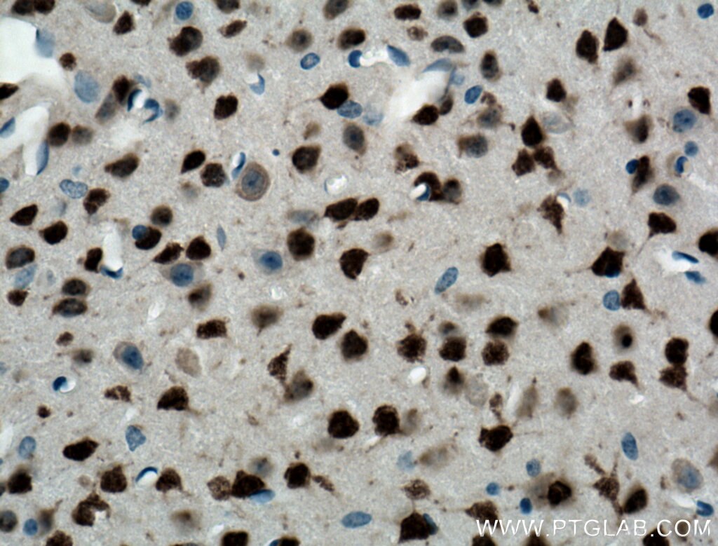 IHC staining of mouse brain using 26975-1-AP