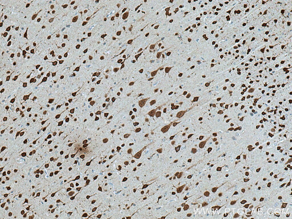 Immunohistochemistry (IHC) staining of rat brain tissue using NeuN Polyclonal antibody (26975-1-AP)