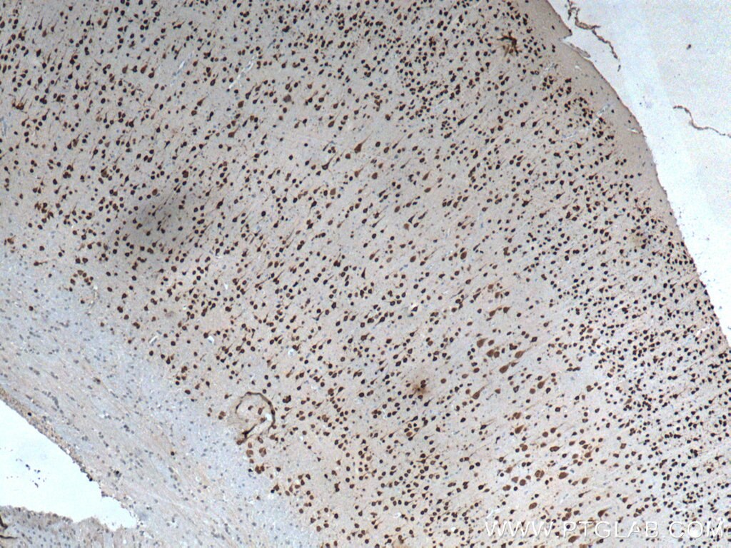 Immunohistochemistry (IHC) staining of rat brain tissue using NeuN Polyclonal antibody (26975-1-AP)
