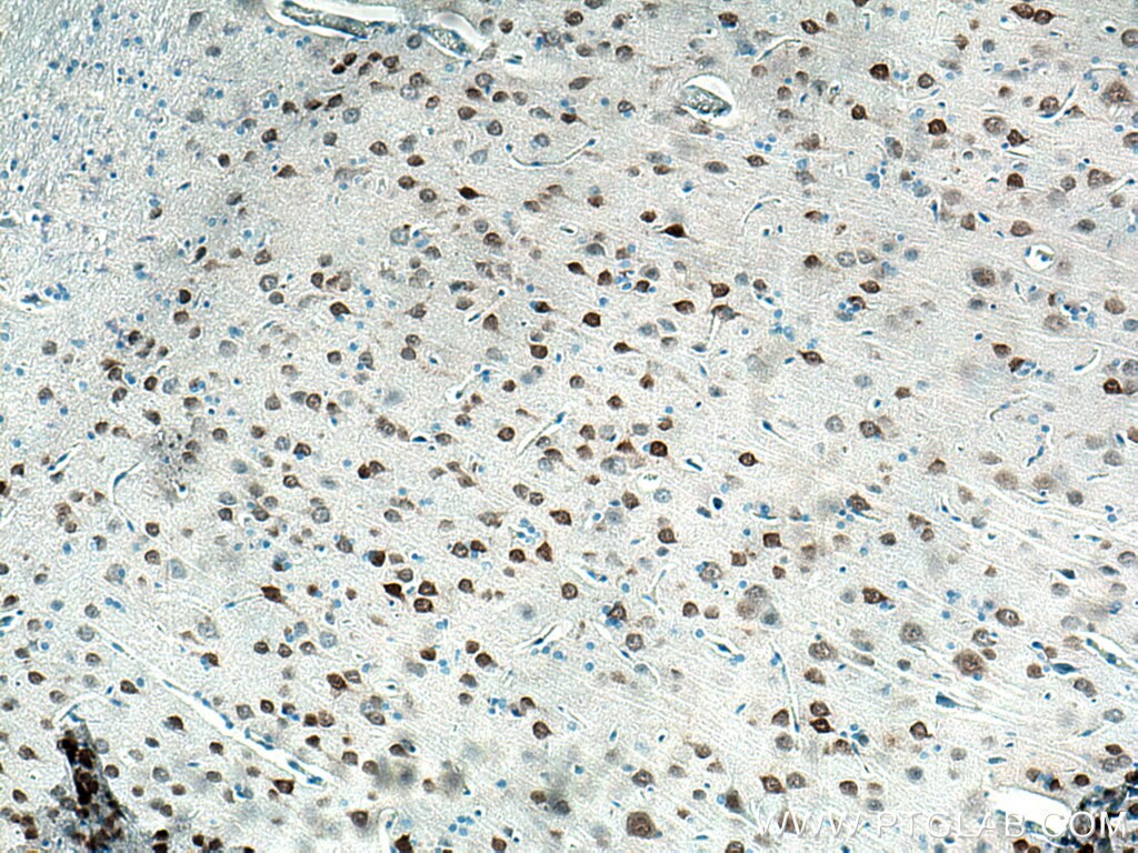 Immunohistochemistry (IHC) staining of rat brain tissue using NeuN Monoclonal antibody (66836-1-Ig)