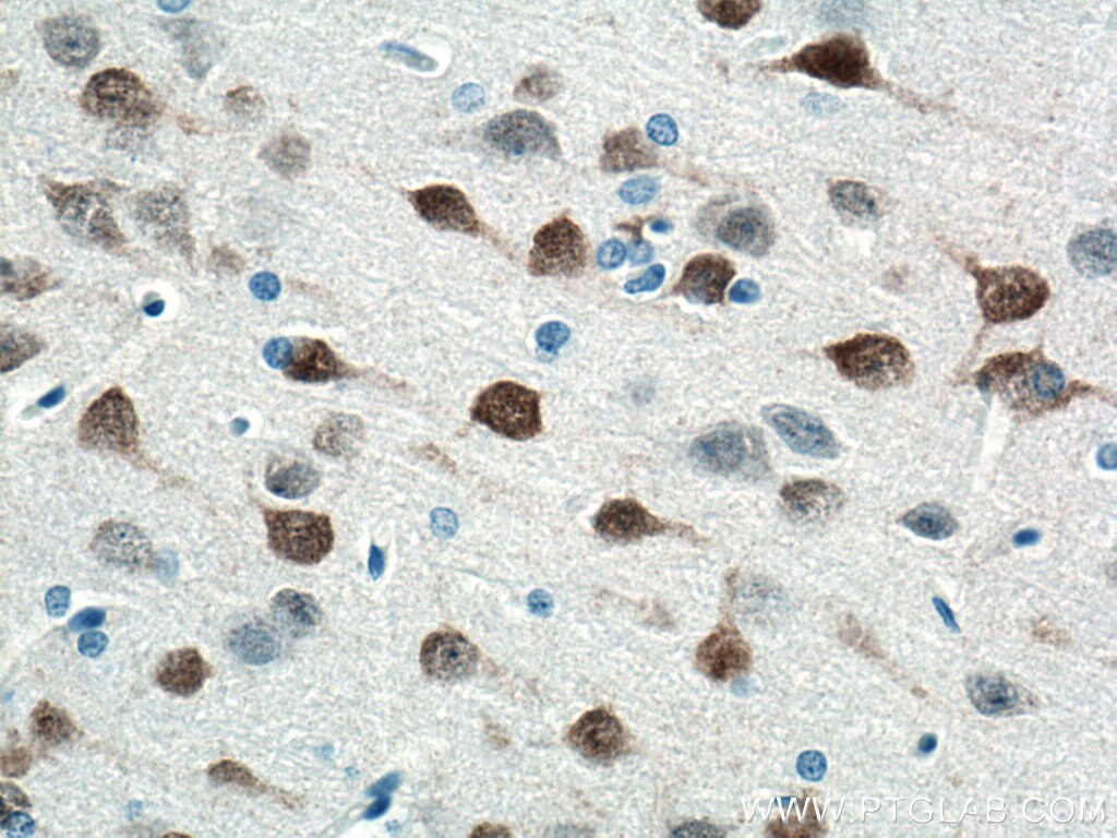 Immunohistochemistry (IHC) staining of rat brain tissue using NeuN Monoclonal antibody (66836-1-Ig)