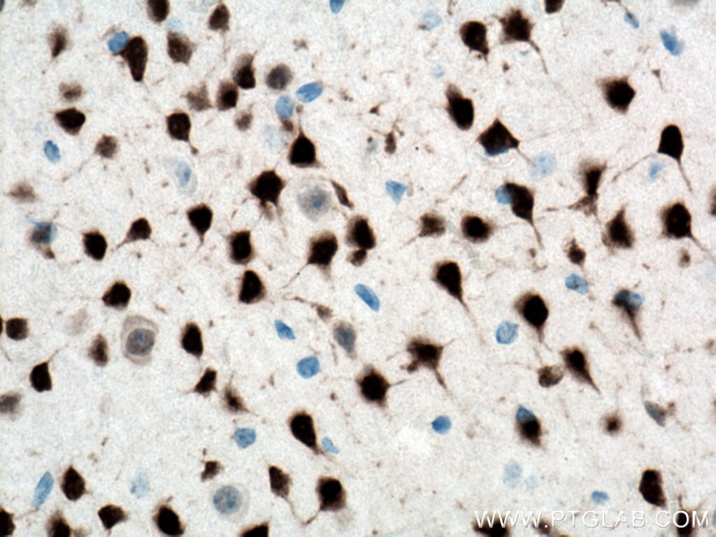 Immunohistochemistry (IHC) staining of mouse brain tissue using NeuN Monoclonal antibody (66836-1-Ig)