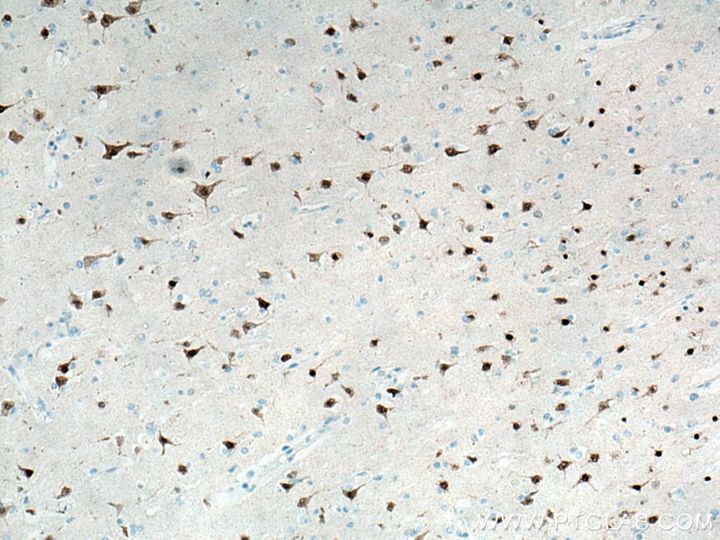 IHC staining of human brain using 66836-1-Ig
