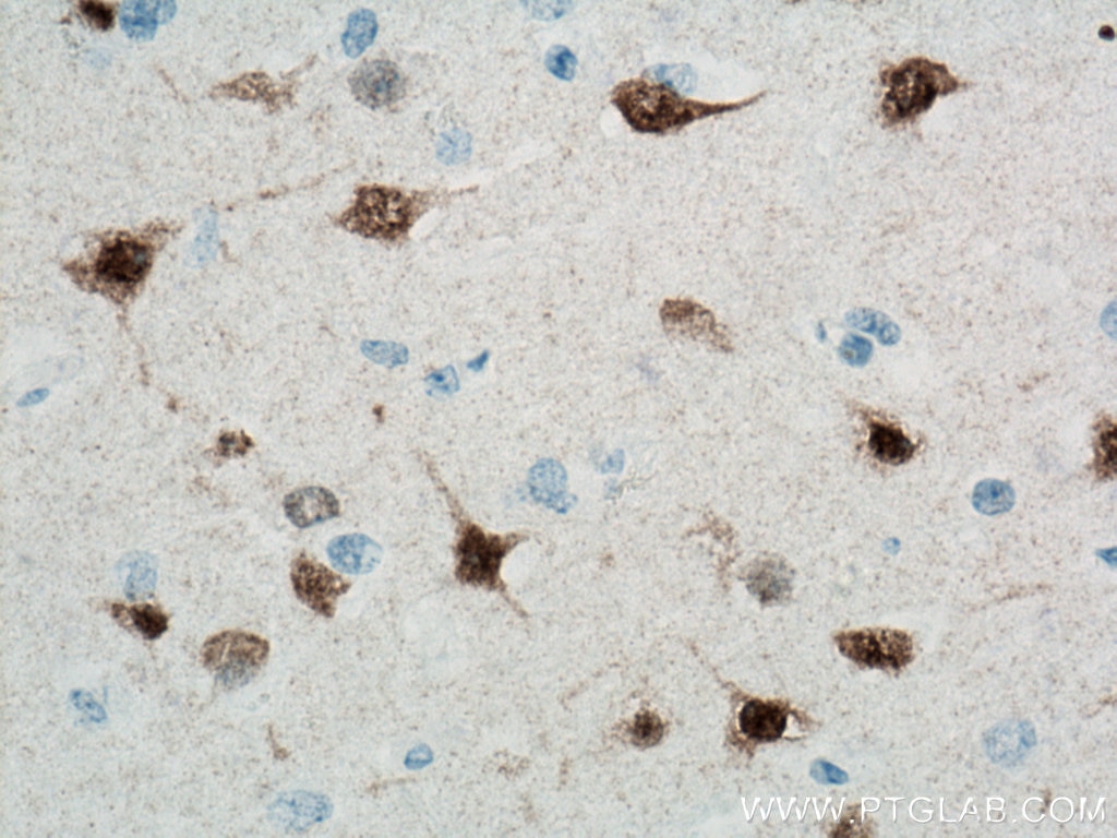 Immunohistochemistry (IHC) staining of human brain tissue using NeuN Monoclonal antibody (66836-1-Ig)