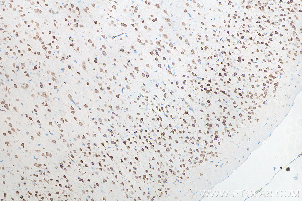 IHC staining of rat brain using 66836-1-Ig Immunohistochemistry (IHC) staining of rat brain tissue using NeuN Monoclonal antibody (66836-1-Ig)