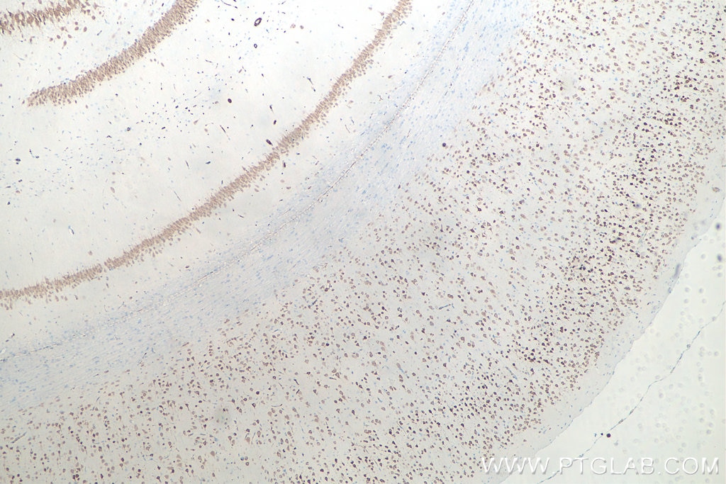 IHC staining of rat brain using 66836-1-Ig Immunohistochemistry (IHC) staining of rat brain tissue using NeuN Monoclonal antibody (66836-1-Ig)