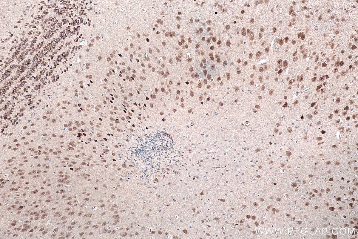 IHC staining of mouse brain using 66836-1-Ig Immunohistochemistry (IHC) staining of mouse brain tissue using NeuN Monoclonal antibody (66836-1-Ig)