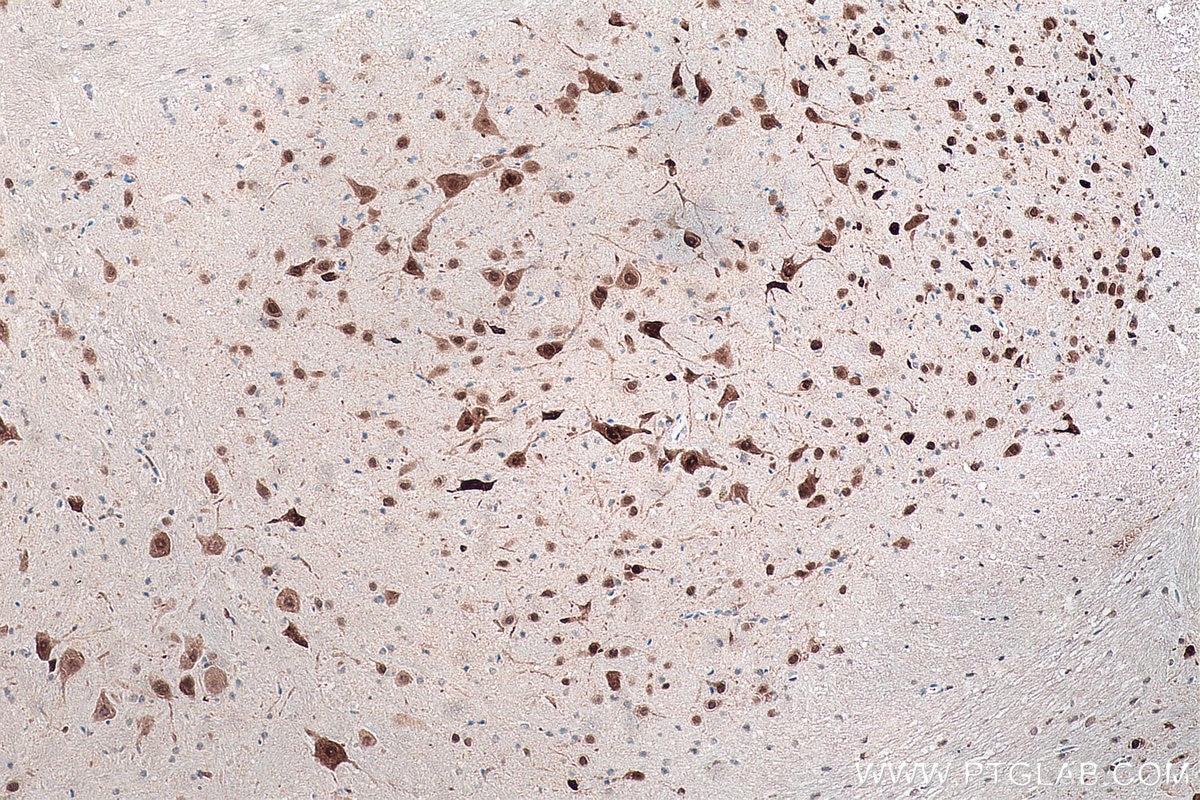 IHC staining of mouse cerebellum using 66836-1-Ig Immunohistochemistry (IHC) staining of mouse cerebellum tissue using NeuN Monoclonal antibody (66836-1-Ig)