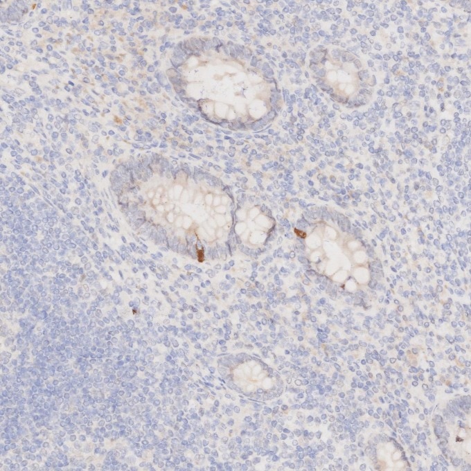 Immunohistochemistry (IHC) staining of human appendicitis tissue using NeuN Monoclonal antibody (66836-1-Ig)