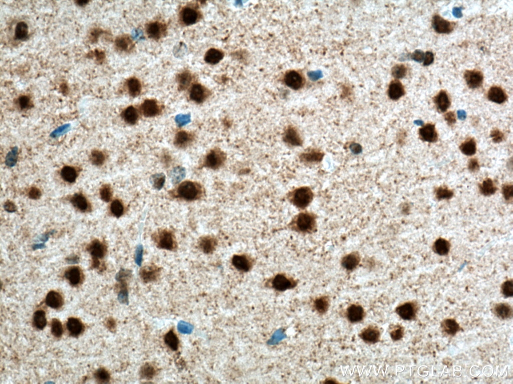 Immunohistochemistry (IHC) staining of mouse brain tissue using Biotin-conjugated NeuN Monoclonal antibody (Biotin-66836)