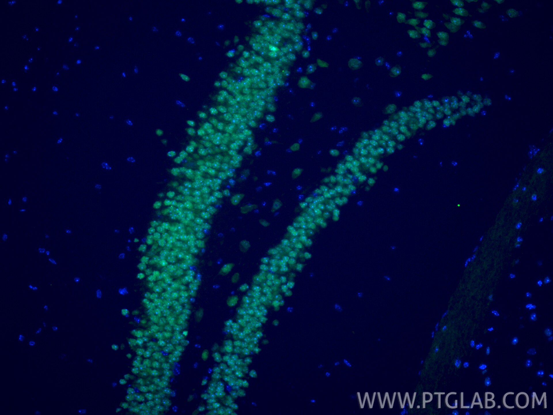 Immunofluorescence (IF) / fluorescent staining of mouse brain tissue using CoraLite® Plus 488-conjugated NeuN Recombinant ant (CL488-84401-4)