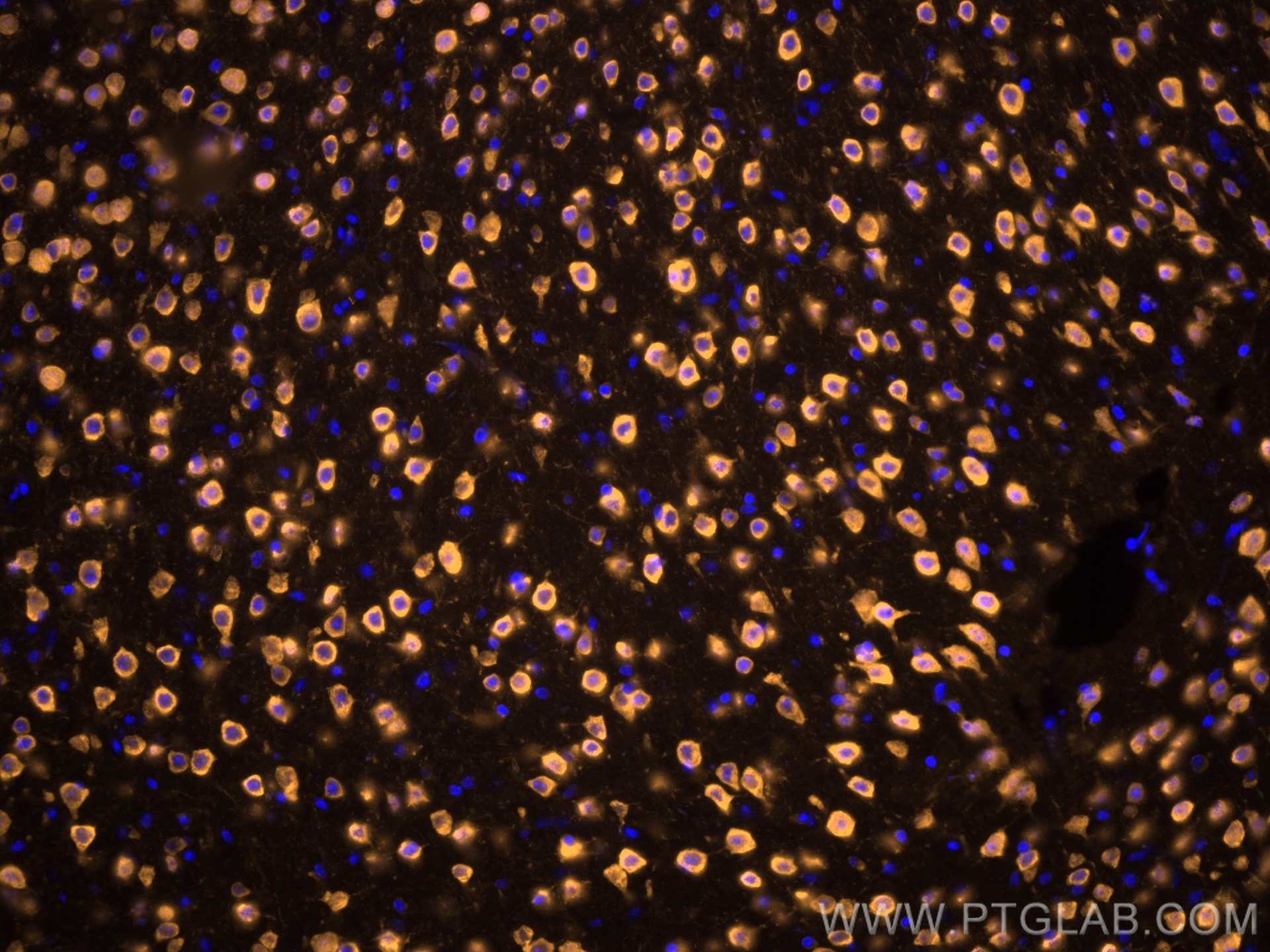 Immunofluorescence (IF) / fluorescent staining of mouse brain tissue using CoraLite®555-conjugated NeuN Polyclonal antibody (CL555-26975)
