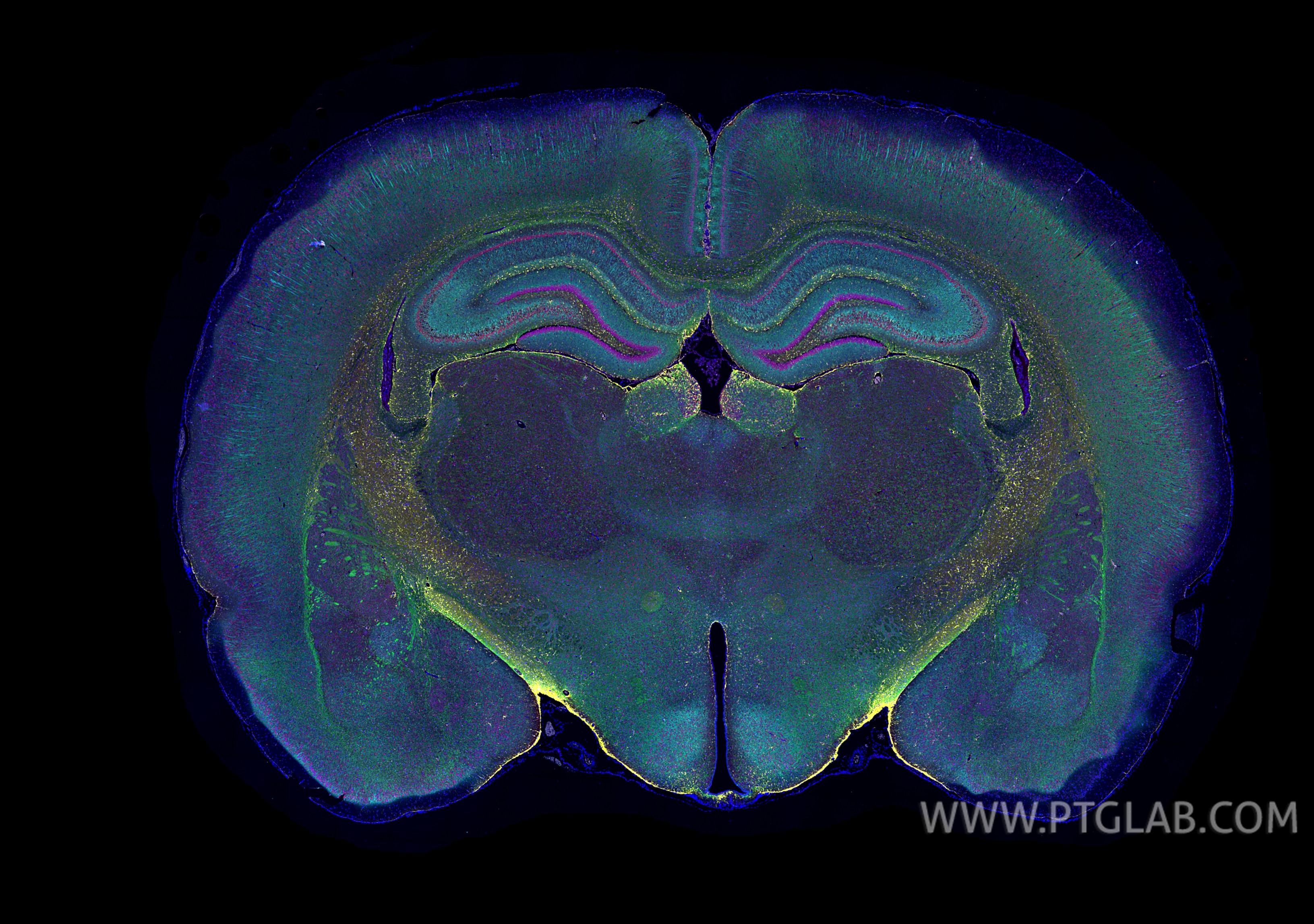 Immunofluorescence (IF) / fluorescent staining of rat brain tissue using CoraLite®594-conjugated NeuN Monoclonal antibody (CL594-66836)