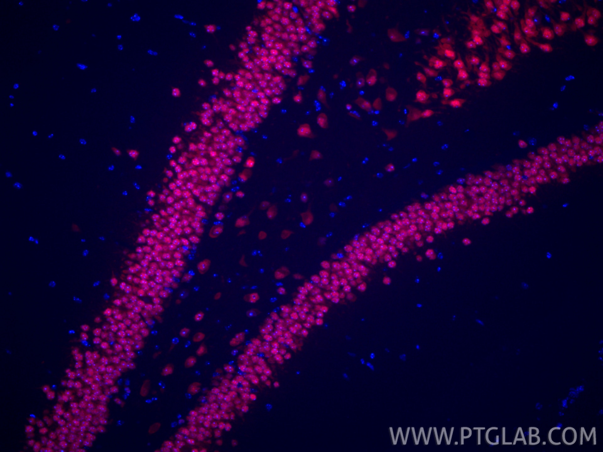 Immunofluorescence (IF) / fluorescent staining of mouse brain tissue using CoraLite®594-conjugated NeuN Recombinant antibody (CL594-84401-4)