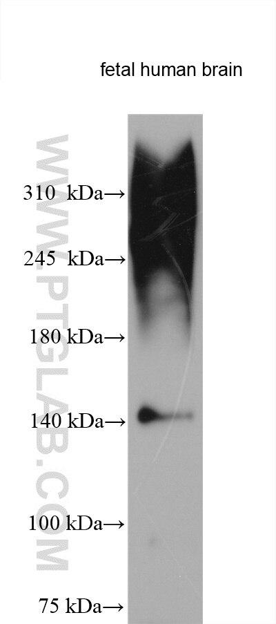 Western Blot (WB) analysis of various lysates using Neurocan Polyclonal antibody (27087-1-AP)