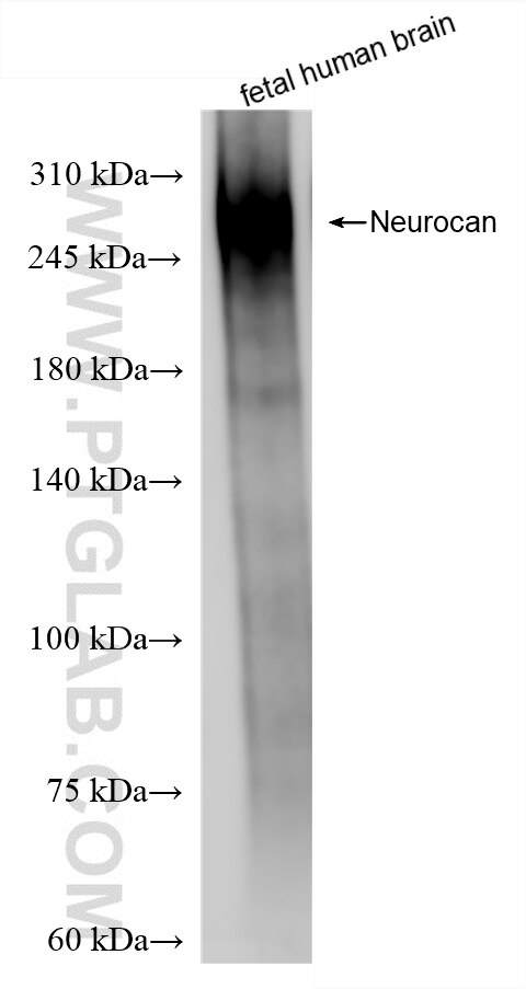 Western Blot (WB) analysis of fetal human brain tissue using Neurocan Recombinant antibody (86279-1-RR)