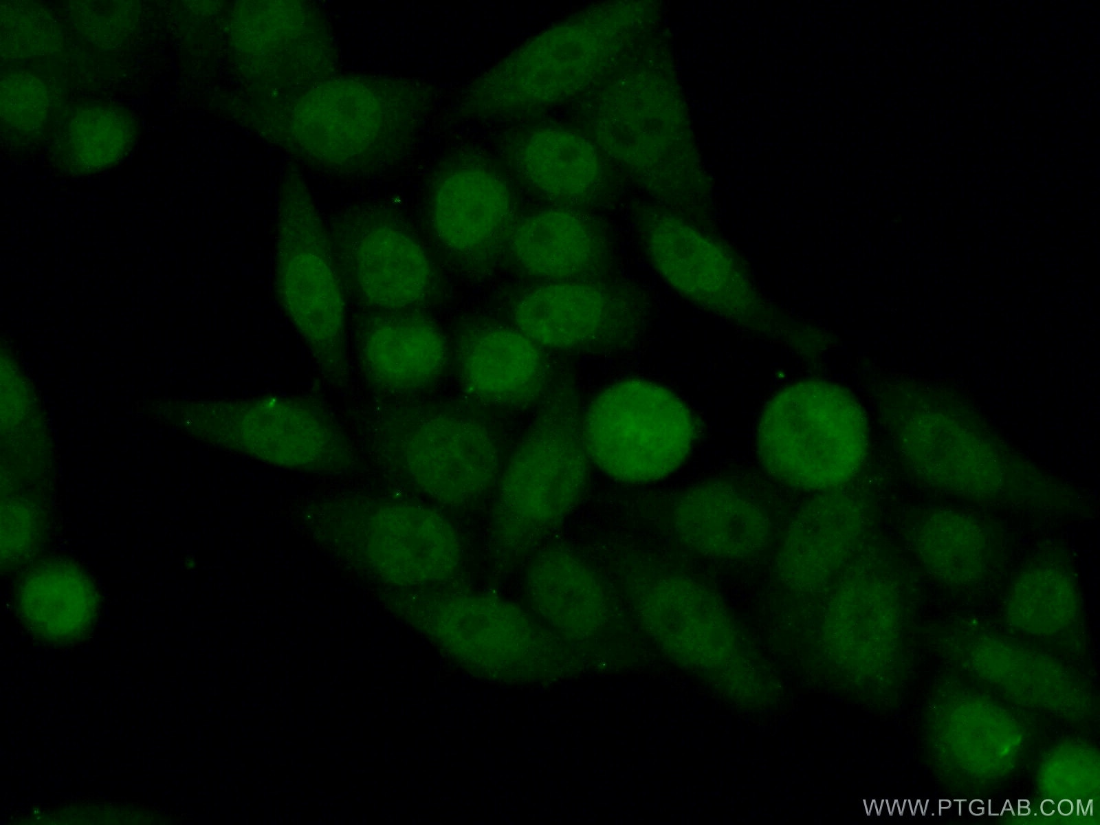 Immunofluorescence (IF) / fluorescent staining of HeLa cells using Neurofibromin 1 Polyclonal antibody (27249-1-AP)