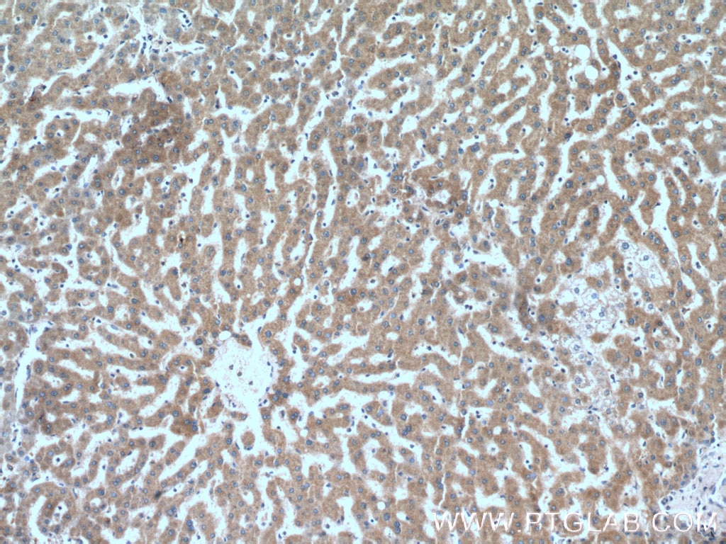Immunohistochemistry (IHC) staining of human liver tissue using Neurofibromin 1 Polyclonal antibody (27249-1-AP)