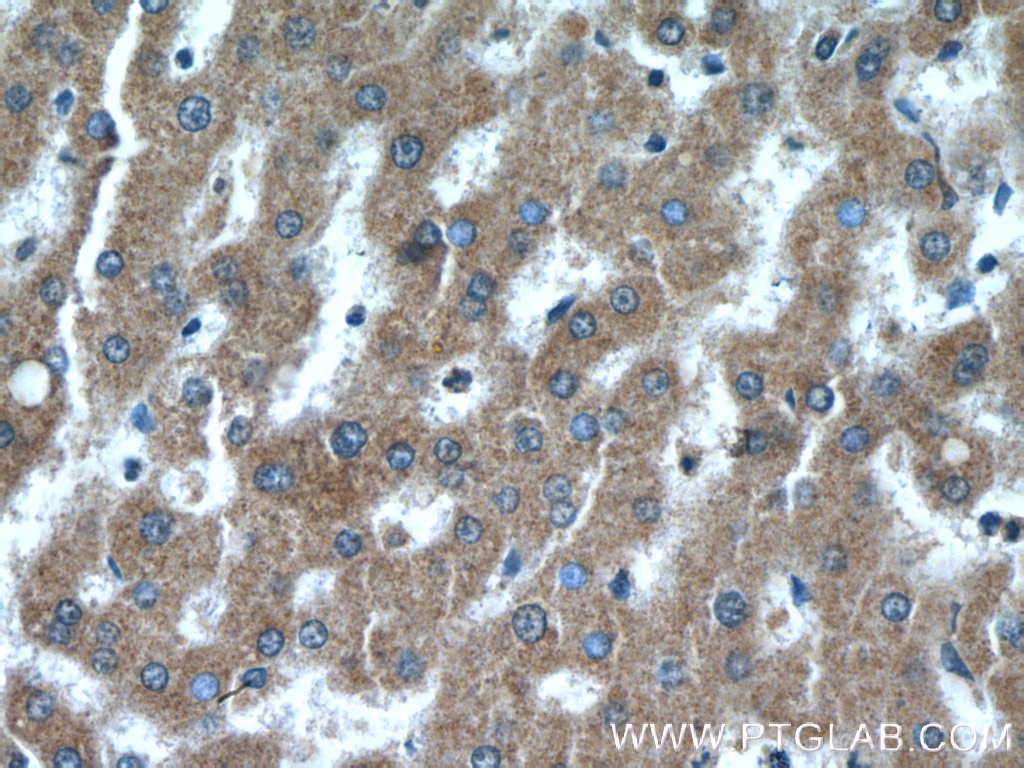Immunohistochemistry (IHC) staining of human liver tissue using Neurofibromin 1 Polyclonal antibody (27249-1-AP)
