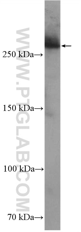 Neurofibromin 1