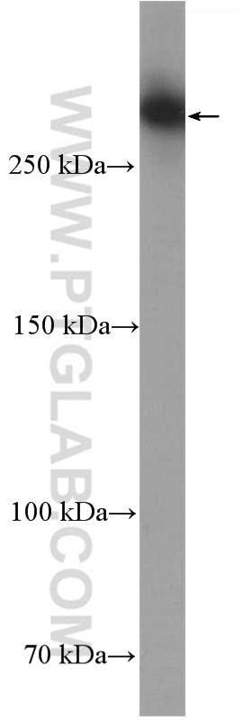 Western Blot (WB) analysis of HeLa cells using Neurofibromin 1 Polyclonal antibody (27249-1-AP)