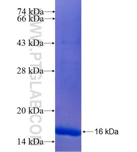 Neurofibromin fusion protein Ag25799 SDS-PAGE