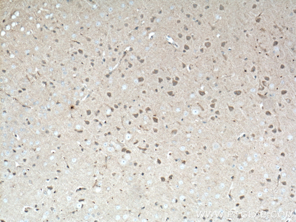 IHC staining of mouse brain using 66781-1-Ig
