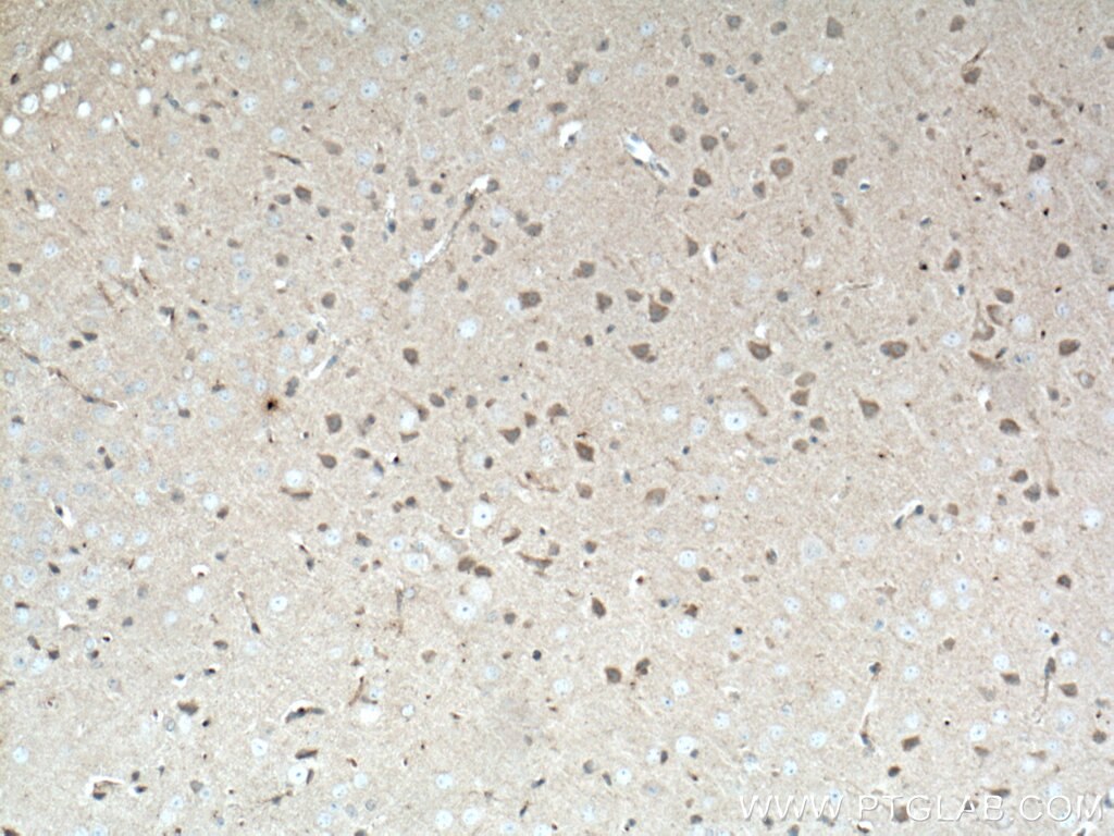 Immunohistochemistry (IHC) staining of mouse brain tissue using Neuromedin B Monoclonal antibody (66781-1-Ig)