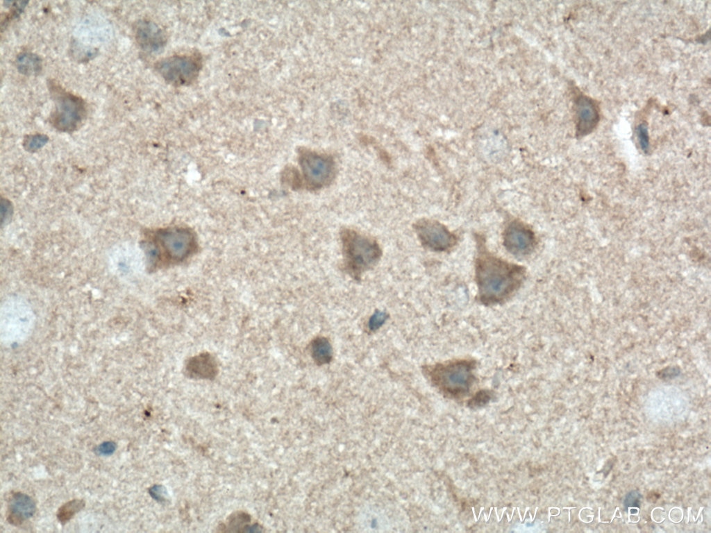 Immunohistochemistry (IHC) staining of mouse brain tissue using Neuromedin B Monoclonal antibody (66781-1-Ig)
