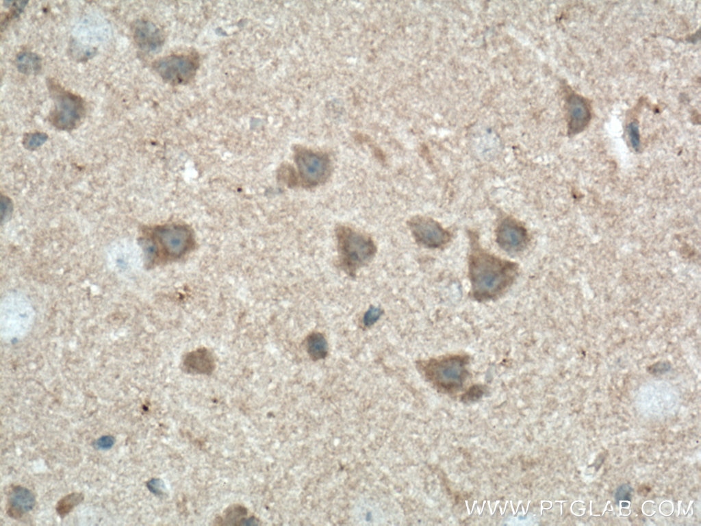 IHC staining of mouse brain using 66781-1-Ig