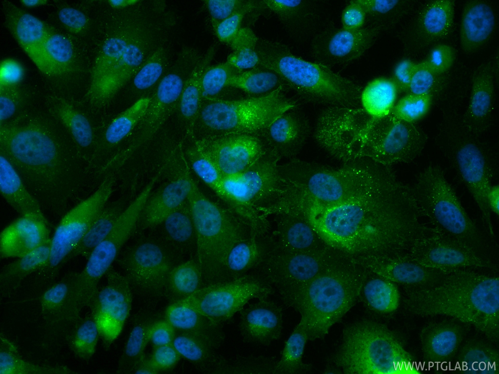 IF Staining of PC-3 using CL488-84429-5 Immunofluorescence (IF) / fluorescent staining of PC-3 cells using CoraLite® Plus 488-conjugated Neuropilin 1/CD304 R (CL488-84429-5)