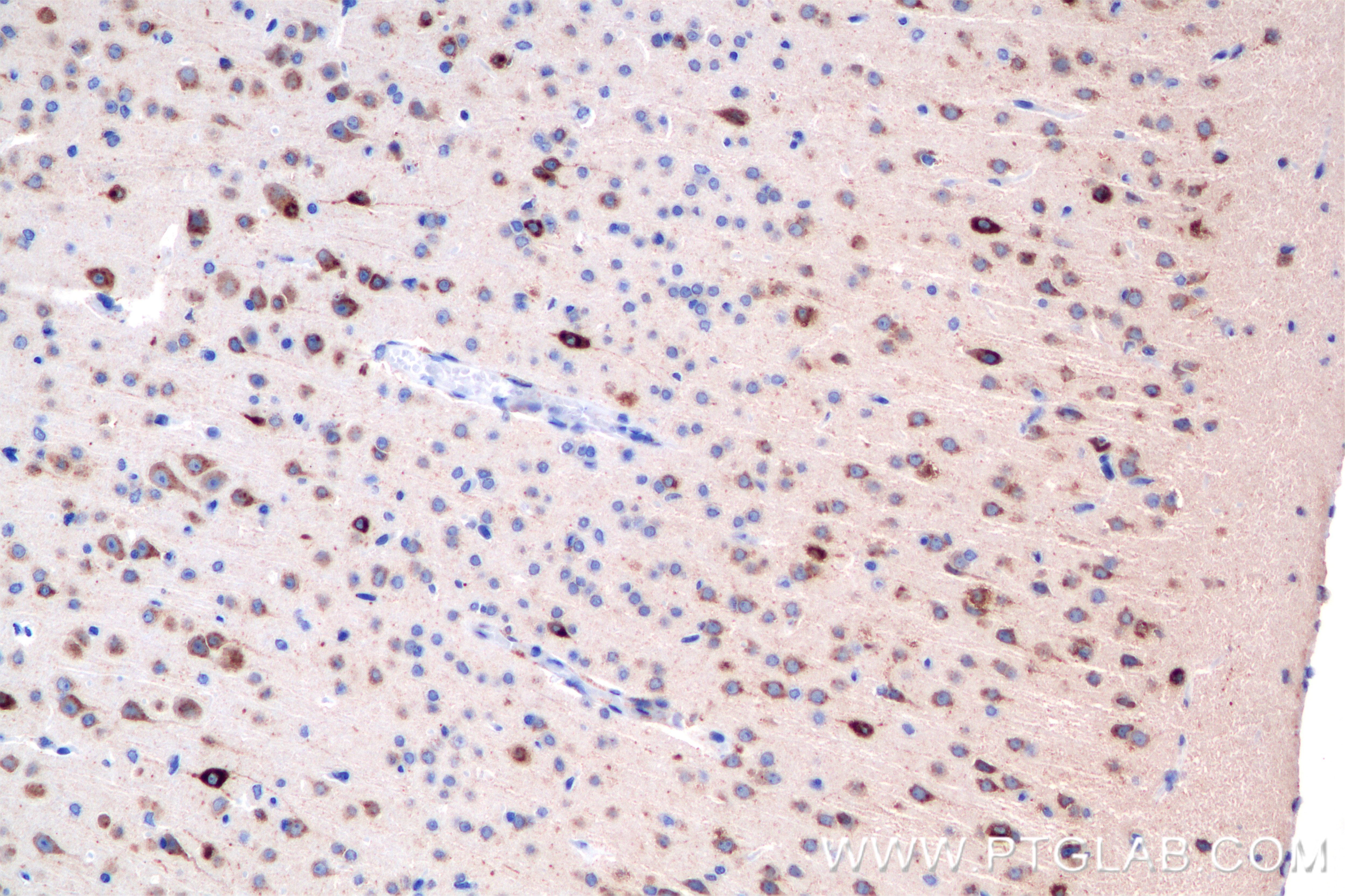 Immunohistochemistry (IHC) staining of mouse brain tissue using Neuroserpin Recombinant antibody (85923-1-RR)