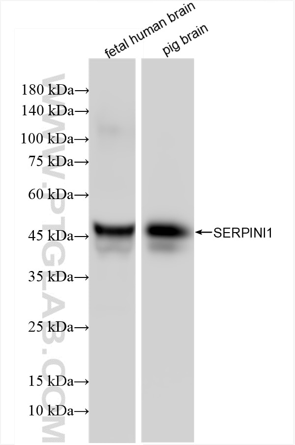 Western Blot (WB) analysis of various lysates using Neuroserpin Recombinant antibody (85923-1-RR)