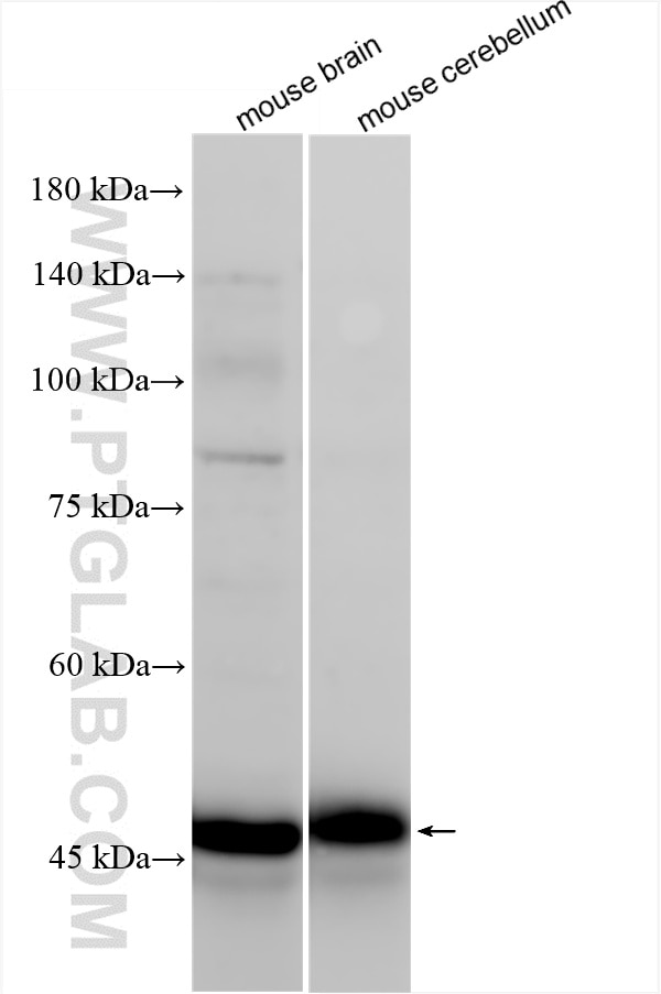 Western Blot (WB) analysis of various lysates using Neuroserpin Recombinant antibody (85923-1-RR)
