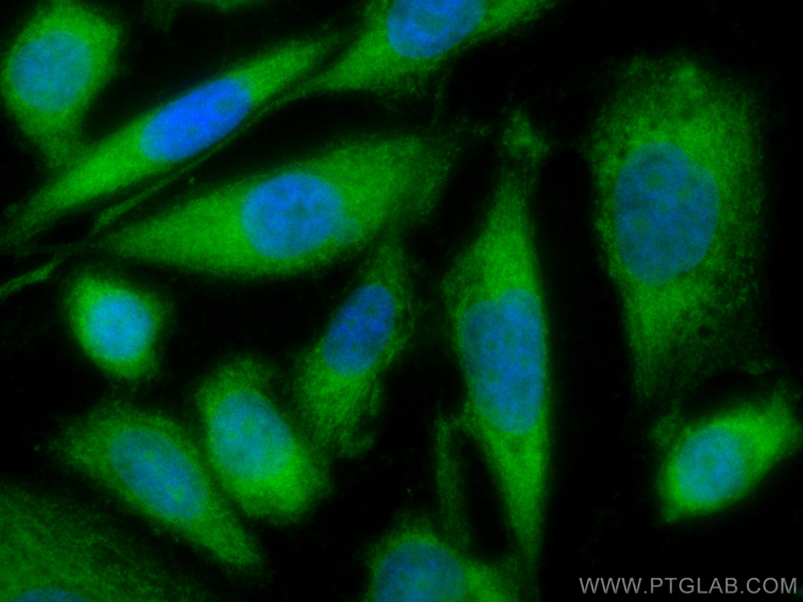 Neurotrophin 4