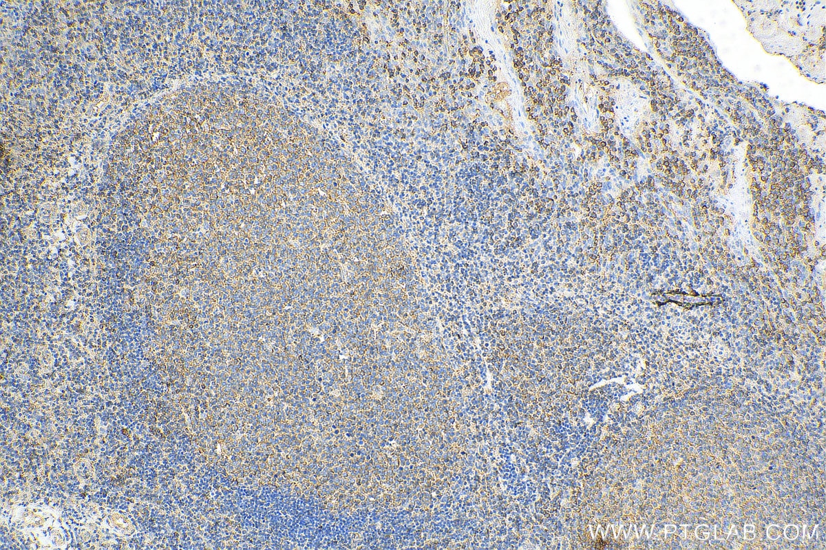 Immunohistochemistry (IHC) staining of human tonsillitis tissue using NeutraKine® IL-10 Monoclonal antibody (69018-1-Ig)