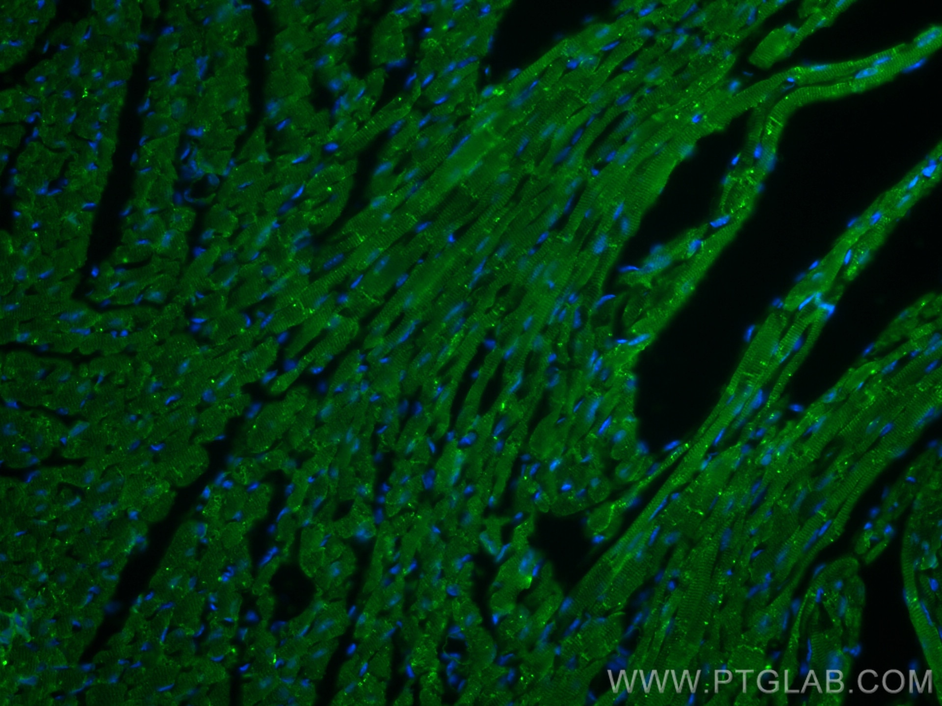 Immunofluorescence (IF) / fluorescent staining of mouse heart tissue using Nexilin Polyclonal antibody (27737-1-AP)