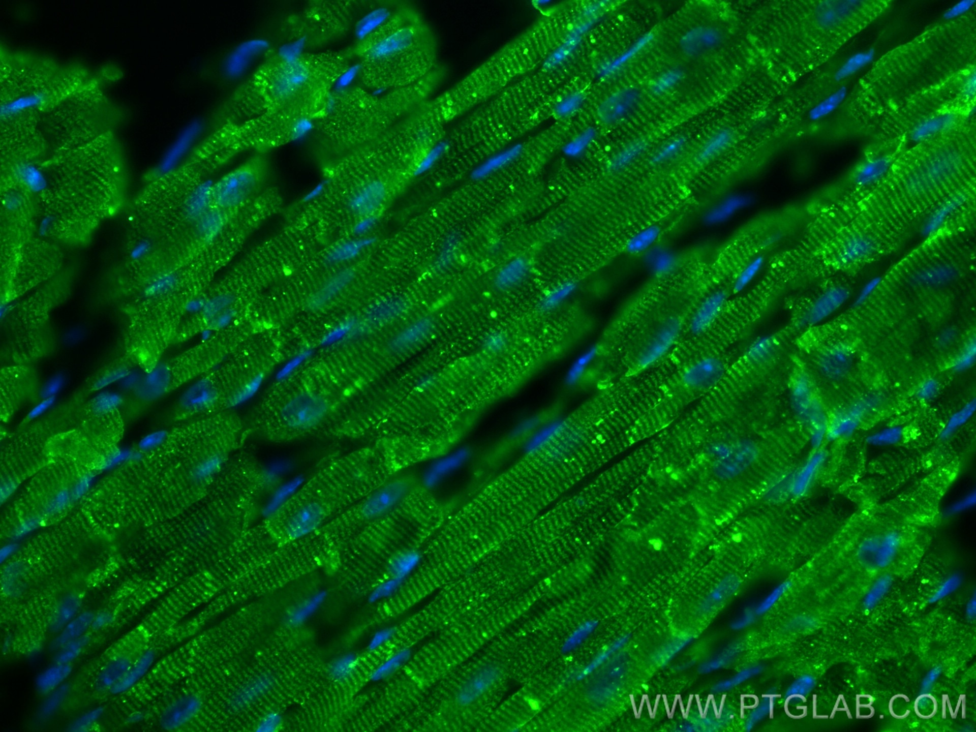 Immunofluorescence (IF) / fluorescent staining of mouse heart tissue using Nexilin Polyclonal antibody (27737-1-AP)