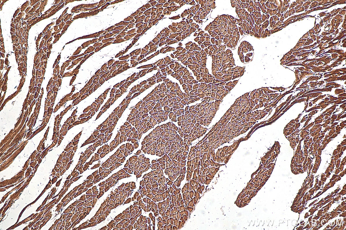 Immunohistochemistry (IHC) staining of mouse heart tissue using Nexilin Polyclonal antibody (27737-1-AP)