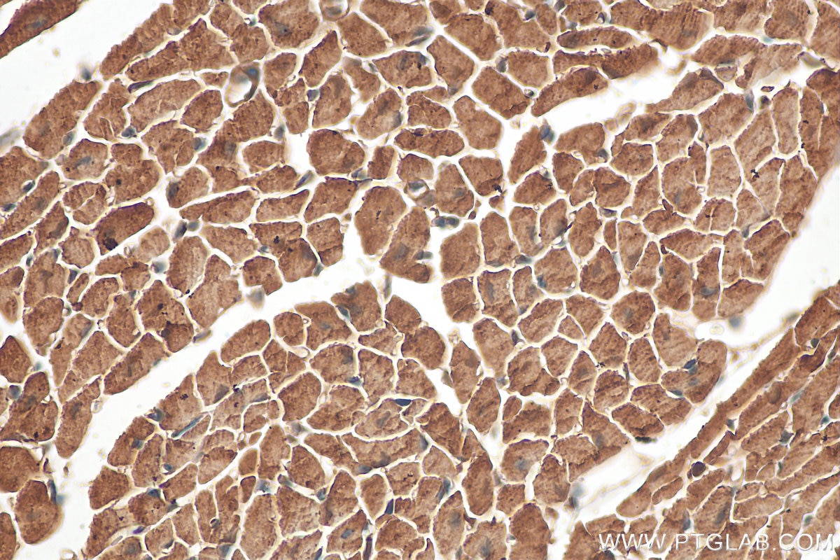 Immunohistochemistry (IHC) staining of mouse heart tissue using Nexilin Polyclonal antibody (27737-1-AP)