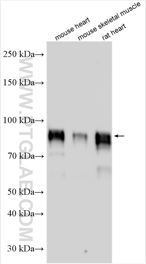 Western Blot (WB) analysis of various lysates using Nexilin Polyclonal antibody (27737-1-AP)