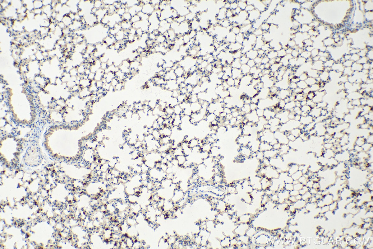 Immunohistochemistry (IHC) staining of mouse lung tissue using mouse Lipocalin-2/Ngal Polyclonal antibody (30576-1-AP)