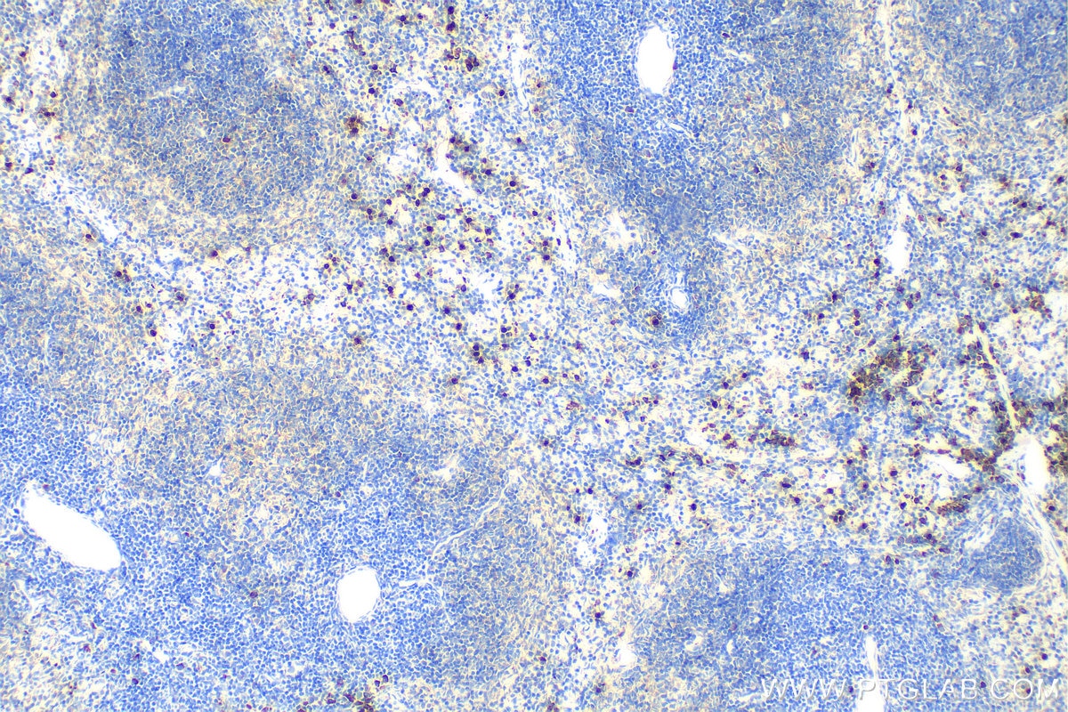 Immunohistochemistry (IHC) staining of mouse spleen tissue using mouse Lipocalin-2/Ngal Polyclonal antibody (30576-1-AP)