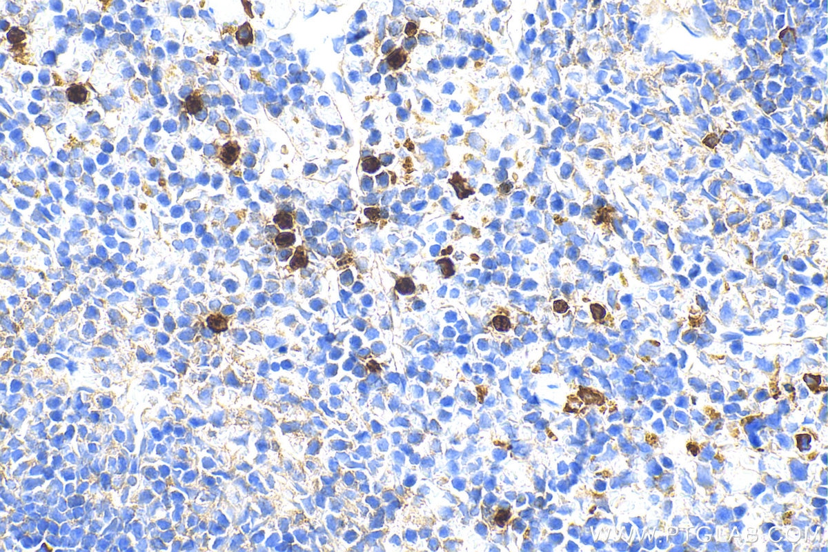 Immunohistochemistry (IHC) staining of mouse spleen tissue using Lipocalin-2/NGAL Polyclonal antibody (30576-1-AP)