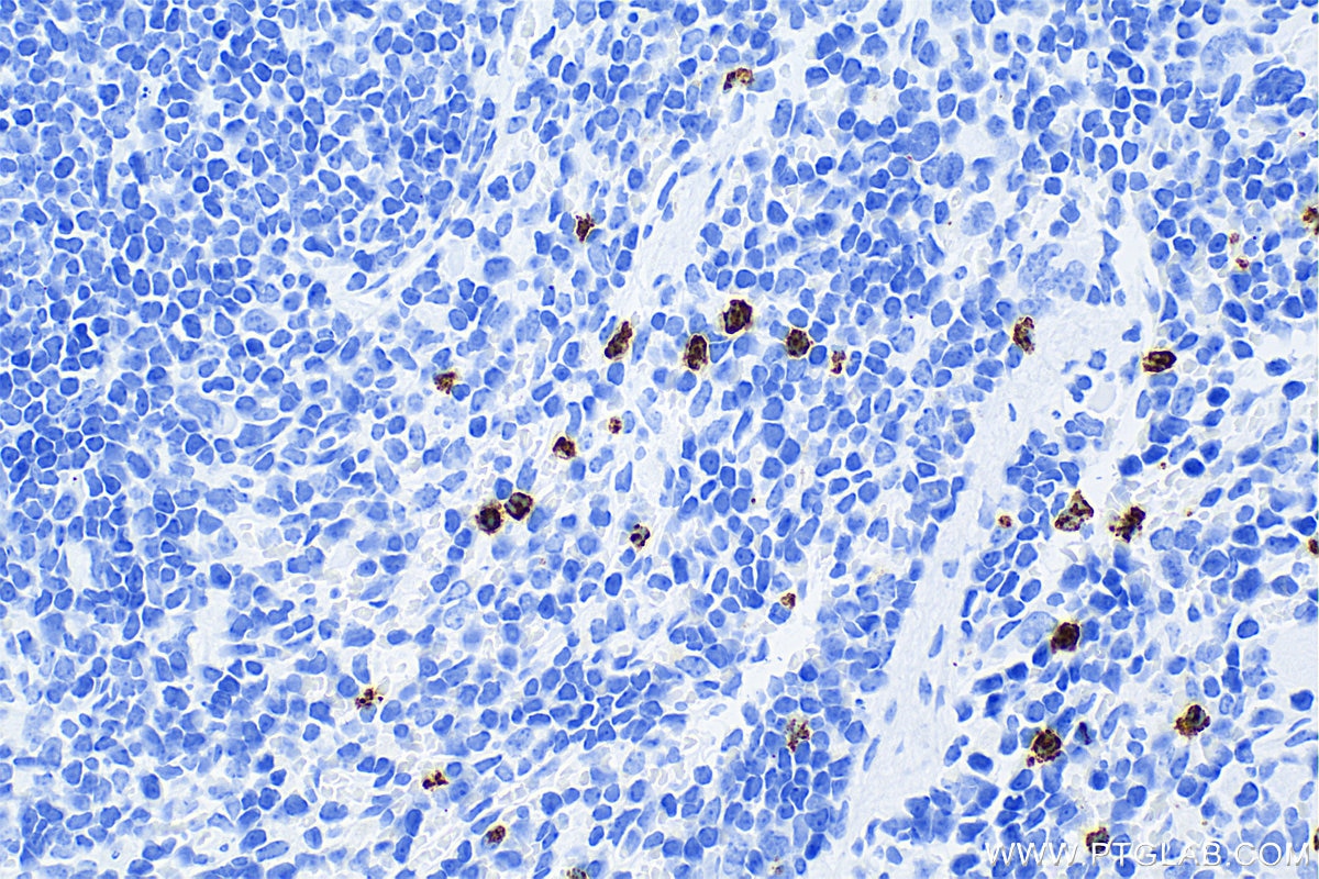 Immunohistochemistry (IHC) staining of mouse spleen tissue using Lipocalin-2/NGAL Recombinant antibody (83102-1-RR)