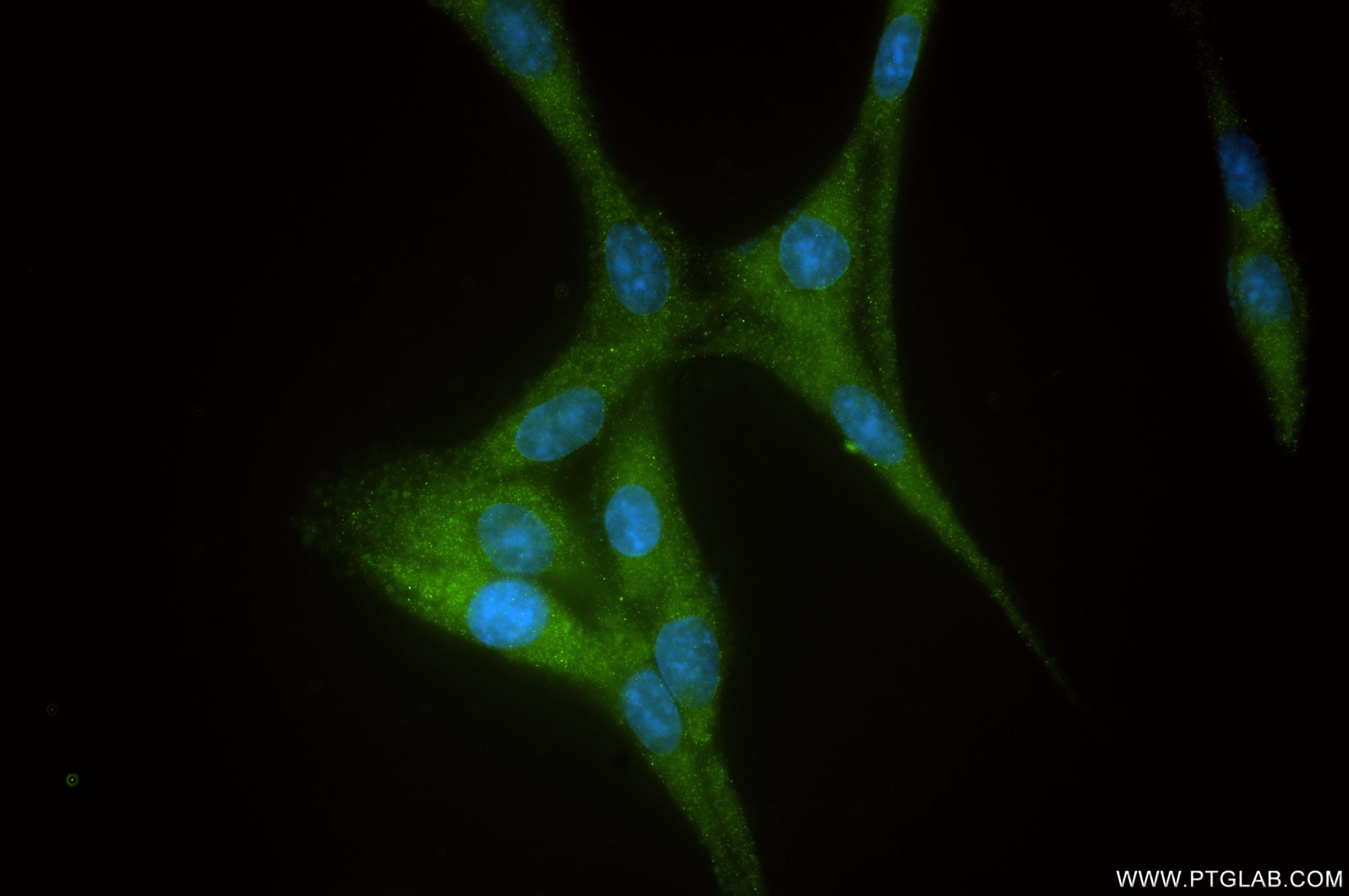 Immunofluorescence (IF) / fluorescent staining of C6 cells using Nicastrin Recombinant monoclonal antibody (87471-1-RR)