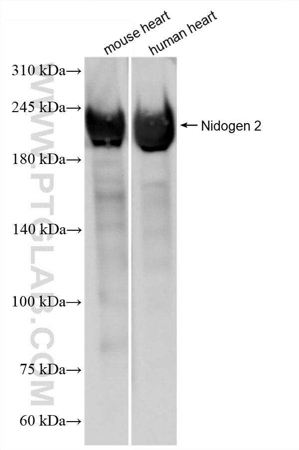 Western Blot (WB) analysis of various lysates using Nidogen 2 Recombinant monoclonal antibody (85299-5-RR)