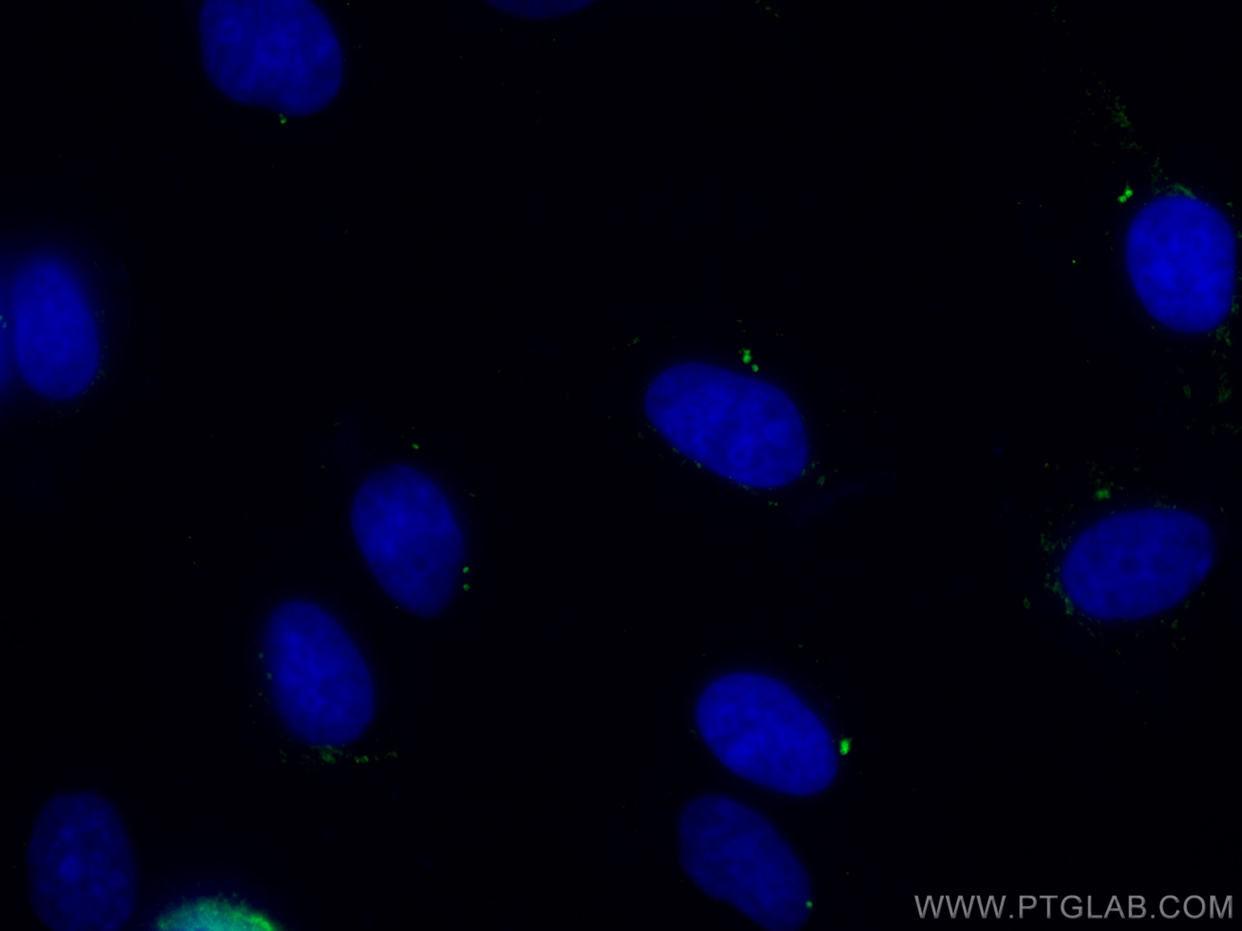 Immunofluorescence (IF) / fluorescent staining of MDCK cells using Ninein Monoclonal antibody (67132-1-Ig)