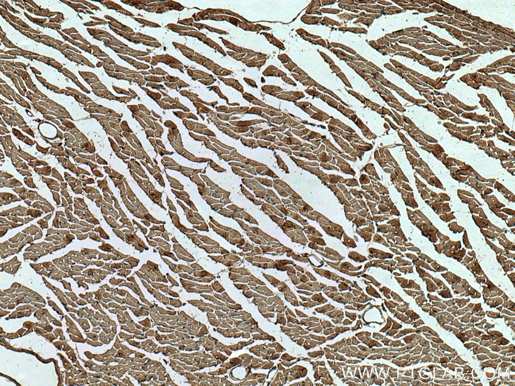 Immunohistochemistry (IHC) staining of mouse heart tissue using Ninein Monoclonal antibody (67132-1-Ig)